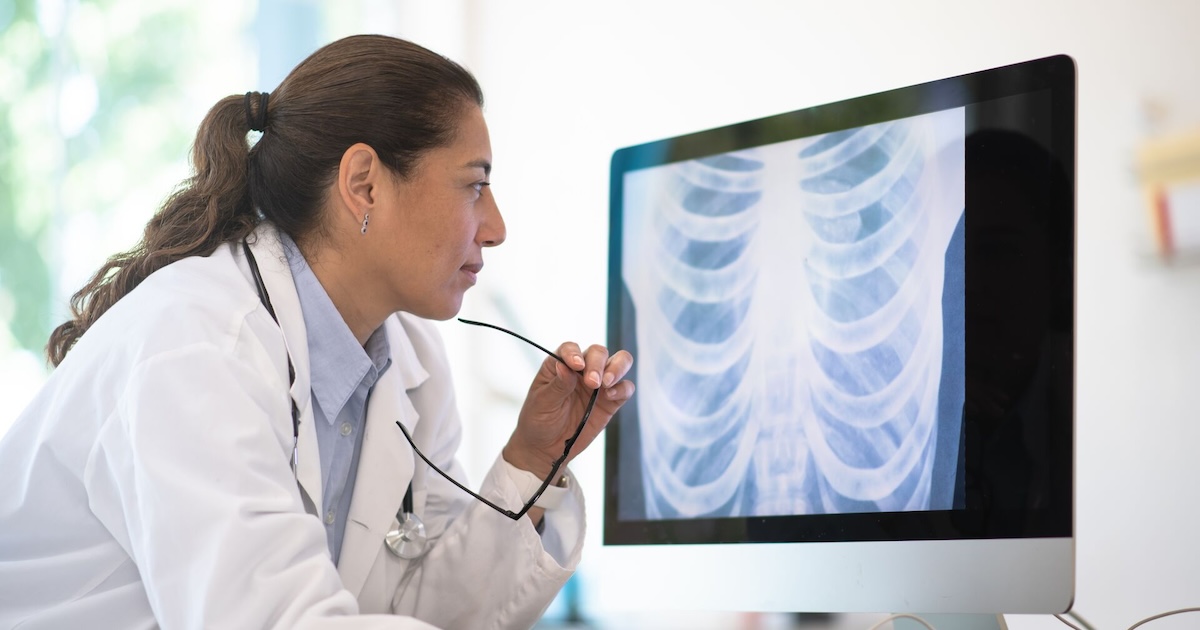 A doctor reviewing a chest X-ray 