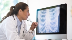 A doctor reviewing a chest X-ray 