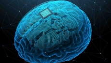 AI illustration of a brain with an implant AI illustration of a brain with an implant