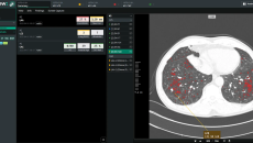 Interface of AVIEW LCS Plus desktop software Interface of AVIEW LCS Plus desktop software