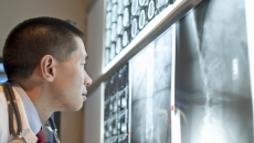 Healthcare provider looking at X-rays on a wall Healthcare provider looking at X-rays on a wall