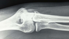 X-ray image X-ray image