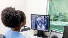 Radiologist looking at CAT scan monitor Radiologist looking at CAT scan monitor