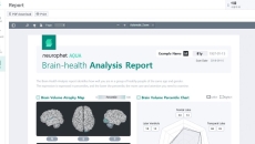 Sample report by Neurophet Aqua