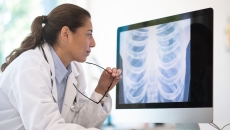 A doctor looking at a chest x-ray A doctor looking at a chest x-ray
