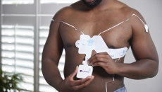 Philips 12-lead ECG system