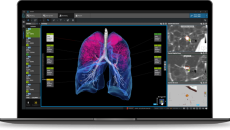 Coreline Soft's flagship product, AVIEW LCS Coreline Soft's flagship product, AVIEW LCS