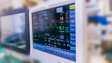 A surgery monitor showing heart data A surgery monitor showing heart data
