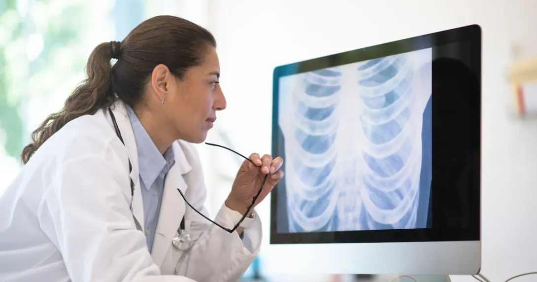 A doctor assessing a chest X-ray scan